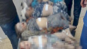 Filistinli doktor, katledilen çocukların başında dünyaya isyan etti