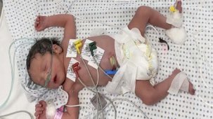 Gazze'de İsrail'in saldırılarında ölen annenin karnındaki bebeği kurtarıldı