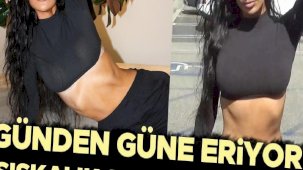Her geçen gün eriyor… Hayranları endişeli: Sıskalık sana yakışmıyor!