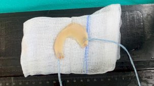 Samsun'da halı sahada dizini sakatladı! Menisküs nakli ameliyatı yapıldı...