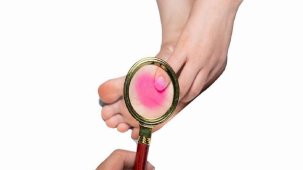 Taban ağrısının sebepleri! Topuk dikenine karşı obezite ve yanlış ayakkabıya dikkat...