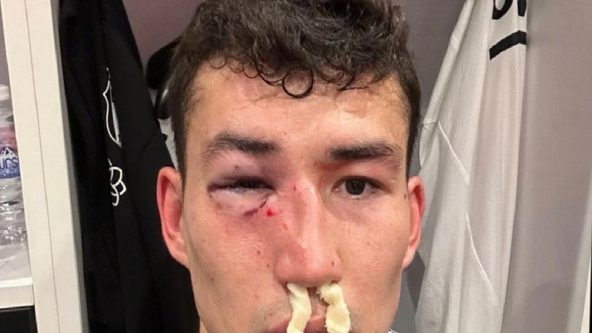 Bahtiyar Zaynutdinov sakatlandı, Beşiktaş'tan tepki geldi