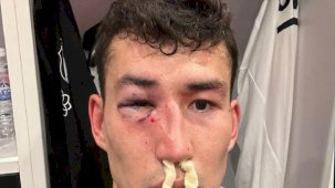 Bahtiyar Zaynutdinov sakatlandı, Beşiktaş'tan tepki geldi