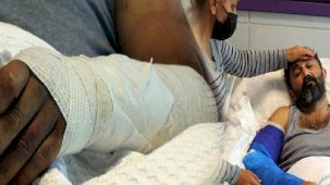 İş kazası geçirdi, kolları çürümek üzereydi! Hayatını değiştiren operasyon