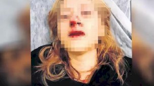 Kaldırım taşıyla dişlerini kırmışlardı: Görmedim dedi