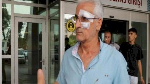 Taksici öğretmene dehşeti yaşattı! Yüzüne 7 dikiş atıldı