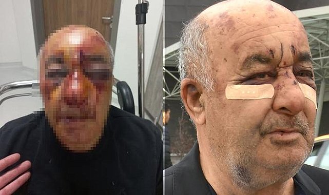 Taksici kabusu yaşadı! '74 yaşındayım, zoruma gidiyor'