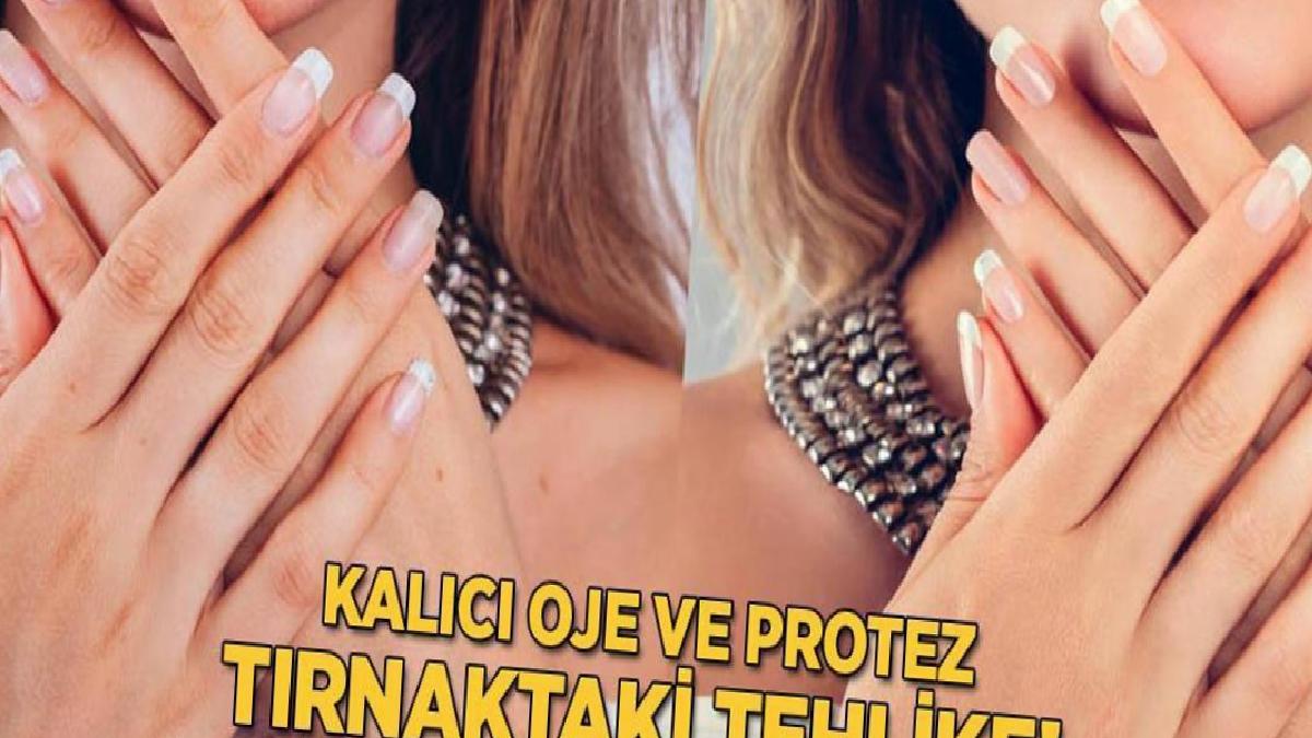 Kalıcı oje ve protez tırnaktaki tehlike! Akrilat alerjisinin geri dönüşü yok