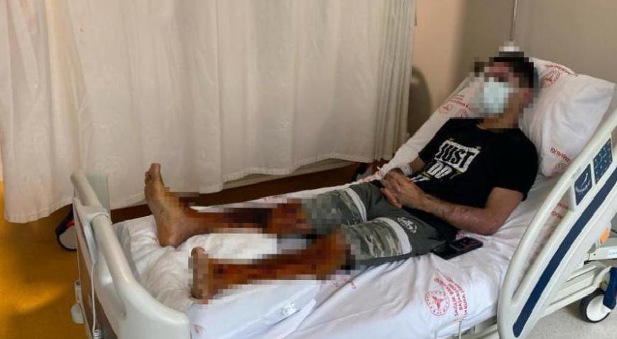 Lavabo açıcı bomba gibi patladı! 'Acı çeke çeke hastaneye gittim'