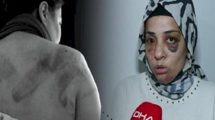 Eski eşe aile boyu dayak: Gözümde sigara söndürüldü