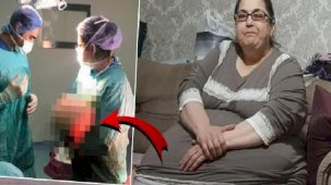 Hareket etmekte güçlük çekiyordu! Vücudundan 25 kiloluk yağ dokusu çıkarıldı