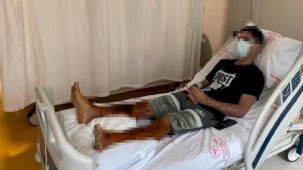 Lavabo açıcı bomba gibi patladı! 'Acı çeke çeke hastaneye gittim'