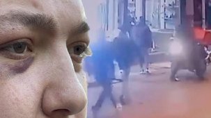 Motokuryeye dehşeti yaşattılar! 'Ellerinde bıçaklarla üzerime çullandılar'