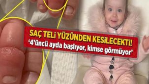 Saç teli yüzünden parmağı kesilecekti! '4'üncü ayda artıyor, kimse görmüyor'
