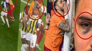 Sosyal medya bunu konuşuyor: Mauro Icardi'nin gözü ne zaman morardı
