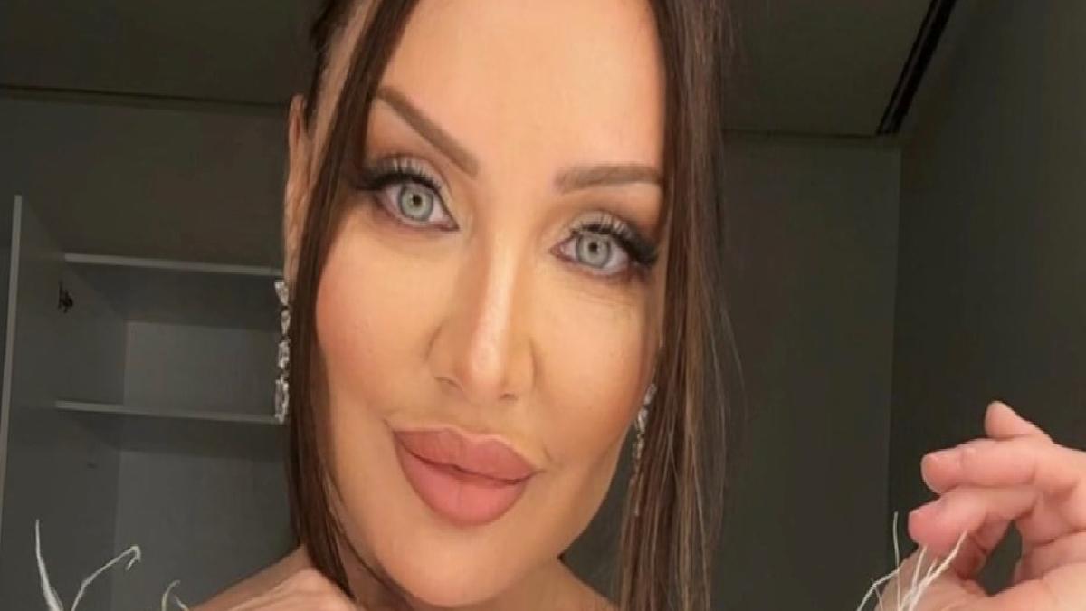 Umut Akyürek'in son yaptırdığı estetik operasyon şoke etti: Alın daraltma