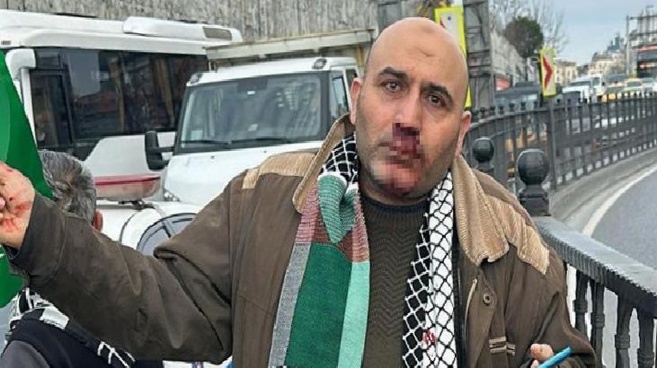 Filistin'e destek yürüyüşünden dönen vatandaşa 'Siz Arap sevicisiniz' diyerek saldırdı
