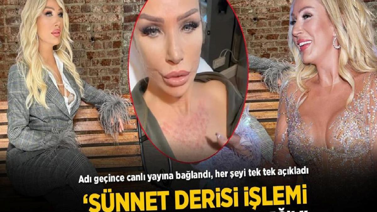 Seda Sayan'dan 'sünnet derisi' açıklaması! Canlı yayında tek tek anlattı