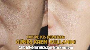 Cilt lekelerinizden korkmayın! Yaz ve kış demeden güneş kremi kullanın