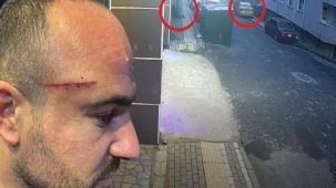 İşe gitmek evden çıktı, dehşeti yaşadı! 'Arabama binen kişi çivili sopayla beni dövdü'