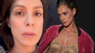 Özge Özpirinçci makyajsız video çekti! Yaptırdığı işlemleri tek tek sıraladı