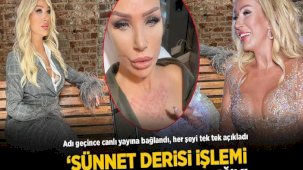 Seda Sayan'dan 'sünnet derisi' açıklaması! Canlı yayında tek tek anlattı