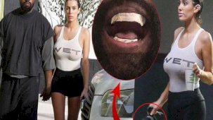 Ünlü rapçinin binlerce dolar harcadığı dişleri eşinin telefonunun arka planında!