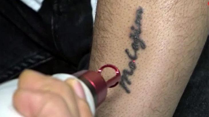 Aşk bitti, dövme silindi: Gitmeyecek dediğim insan gitti