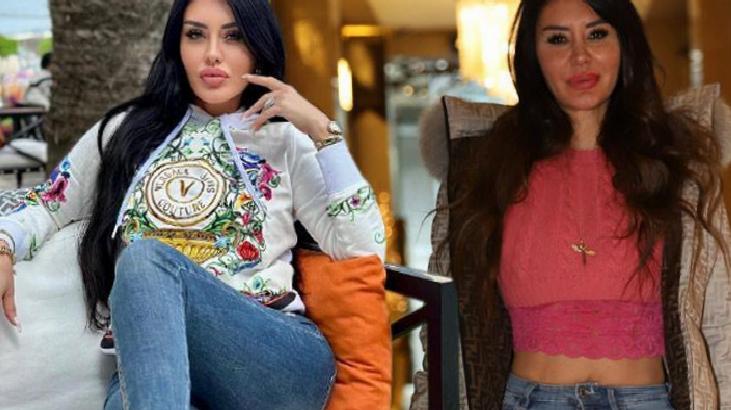 Ebru Polat: Kurunun yanında yaş da yanıyor!