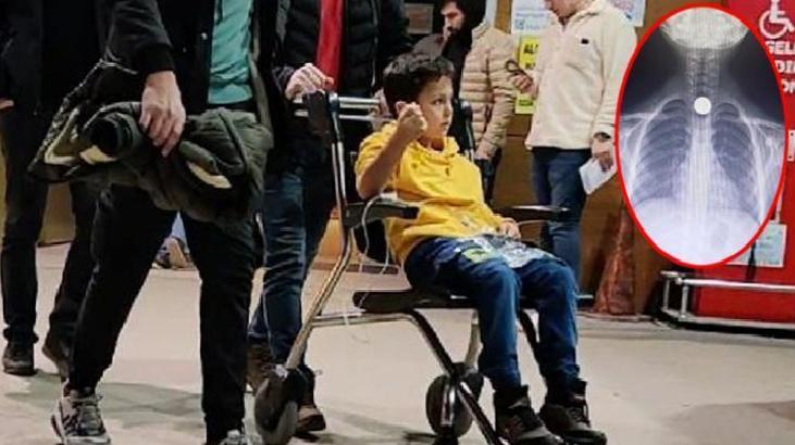 Minik Ahmet bozuk para yuttu yemek borusuna takıldı