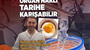Dünya tıp tarihine geçecek çalışmalarda Türk imzası: Organ nakli tarihe karışabilir!