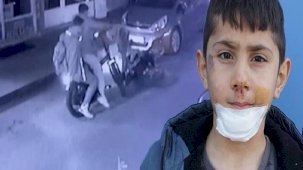 Motosikletlinin çarpıp kaçtı! 7 yaşındaki Yiğit Efe hastanelik oldu