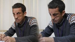 Yüz nakli ameliyatı ile yeni hayatına başlayan Uğur Acar'ın yeni hedefi