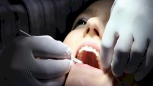 Bilimsel keşif ortaya çıkardı! Tahıl ve şekerler diş çürüklerini artırdı