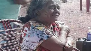 Brezilya'da 56 Yıldır karnında taşıdığı taşa dönüşmüş bebeğin çıkarılması için ameliyat olan kadın, ameliyattan bir gün sonra hayatını kaybetti