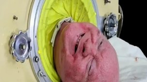 Demir akciğerde yaşayan Paul Alexander hayatını kaybetti