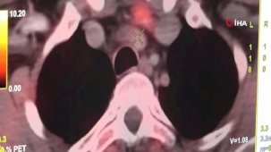 Diyarbakır'da hastalar Kolin PET görüntüleme yöntemiyle şifa buluyor