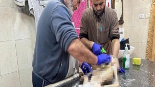 Gazze'de yeterli beslenemeyen 10 yaşındaki çocuk bir deri bir kemik halde öldü