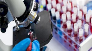 HIV'i Ayırmak İçin CRISPR Teknolojisi Kullanıldı