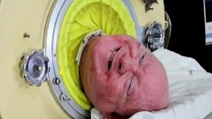 Metal bir kapsül içinde 72 yılını geçiren ve 