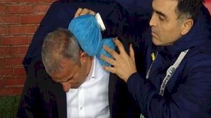 Trabzonspor maçında İsmail Kartal'a yabancı madde isabet etti