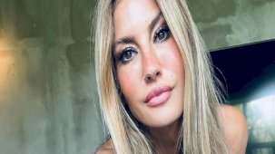 Çağla Şıkel dudaklarındaki değişimiyle şaşırttı! Son halini görenler yorum yağdırdı