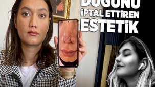 Düğünü iptal ettiren estetik! Doktordan skandal sözler: Sen de ne kadar şanssızsın