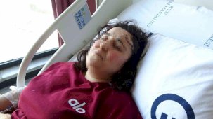 Boşanma aşamasındaki kocasından bıçaklı saldırıya uğrayan kadın tedavi altında