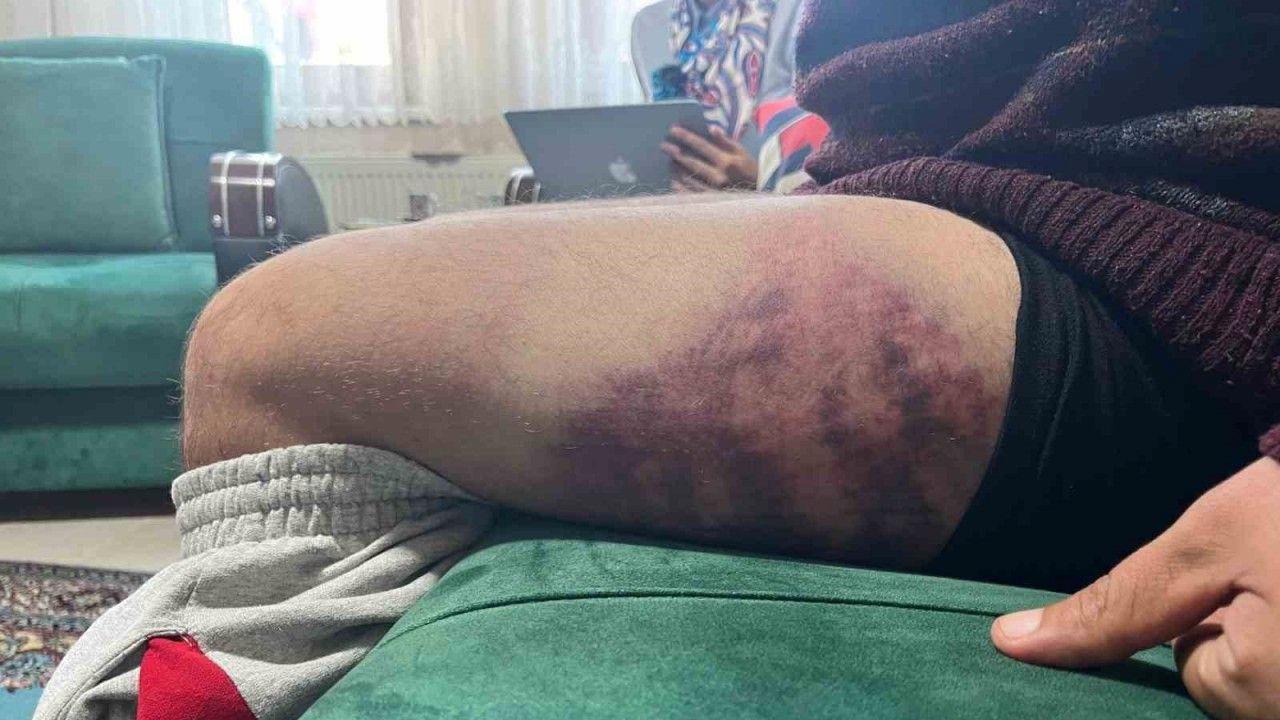 Vicdanları yaralayan olay: Otizmli şahıs odunluğa baktı diye odunla darbedildi