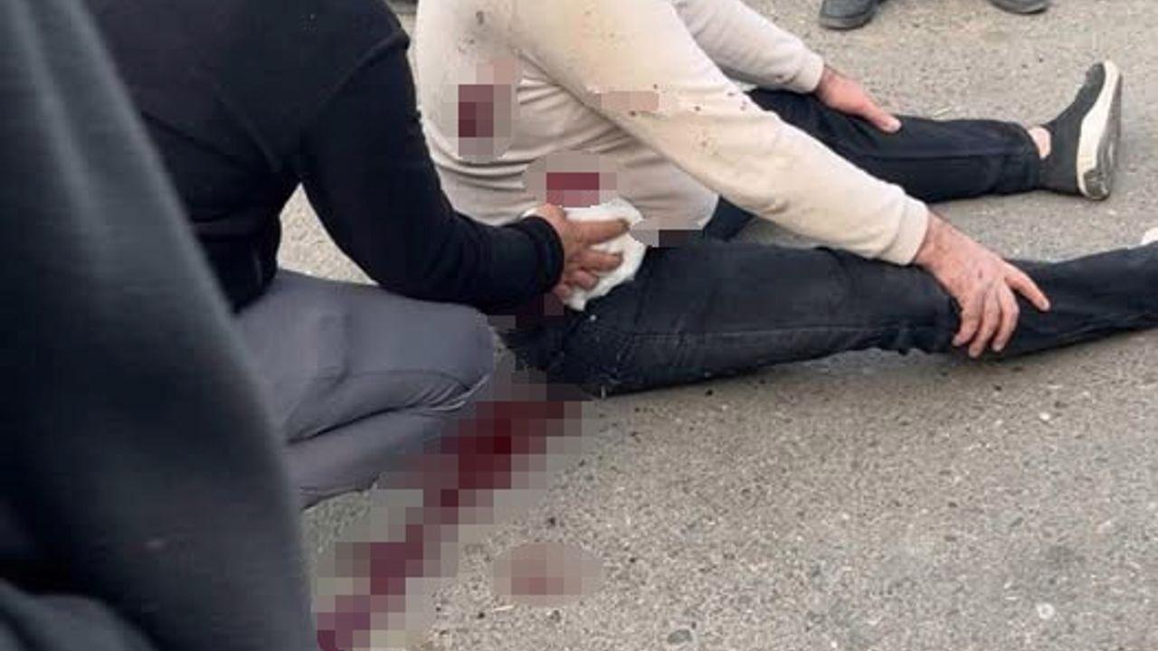 Şanlıurfa’da bıçaklı kavga: 1 yaralı