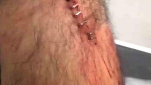 Şanlıurfa’da görev yapan öğretmene sokak ortasında jiletli saldırı