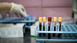 Dünyada her yıl 20 milyon, Türkiye'de ise 240 bin kişi kanser tanısı alıyor