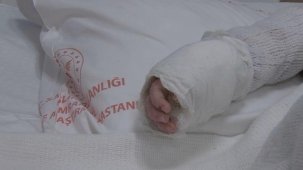 İstanbul'da bebeğin üzerine kaynar su döküldü: Vücudunun yüzde 27'si yandı